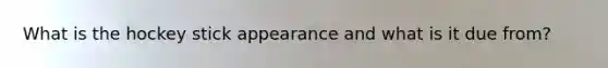 What is the hockey stick appearance and what is it due from?