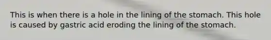 This is when there is a hole in the lining of the stomach. This hole is caused by gastric acid eroding the lining of the stomach.