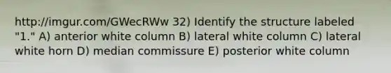 http://imgur.com/GWecRWw 32) Identify the structure labeled "1." A) anterior white column B) lateral white column C) lateral white horn D) median commissure E) posterior white column