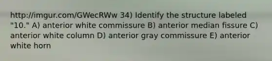 http://imgur.com/GWecRWw 34) Identify the structure labeled "10." A) anterior white commissure B) anterior median fissure C) anterior white column D) anterior gray commissure E) anterior white horn