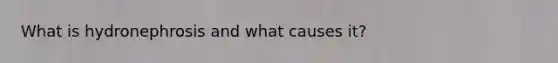 What is hydronephrosis and what causes it?