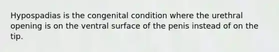 Hypospadias is the congenital condition where the urethral opening is on the ventral surface of the penis instead of on the tip.