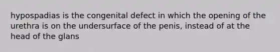 hypospadias is the congenital defect in which the opening of the urethra is on the undersurface of the penis, instead of at the head of the glans