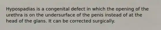 Hypospadias is a congenital defect in which the opening of the urethra is on the undersurface of the penis instead of at the head of the glans. It can be corrected surgically.