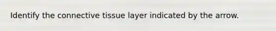 Identify the connective tissue layer indicated by the arrow.