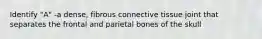 Identify "A" -a dense, fibrous connective tissue joint that separates the frontal and parietal bones of the skull