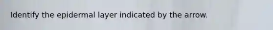 Identify the epidermal layer indicated by the arrow.