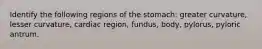 Identify the following regions of the stomach: greater curvature, lesser curvature, cardiac region, fundus, body, pylorus, pyloric antrum.