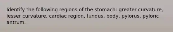 Identify the following regions of <a href='https://www.questionai.com/knowledge/kLccSGjkt8-the-stomach' class='anchor-knowledge'>the stomach</a>: greater curvature, lesser curvature, cardiac region, fundus, body, pylorus, pyloric antrum.