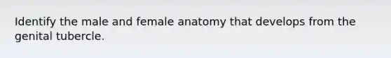 Identify the male and female anatomy that develops from the genital tubercle.