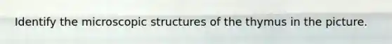 Identify the microscopic structures of the thymus in the picture.