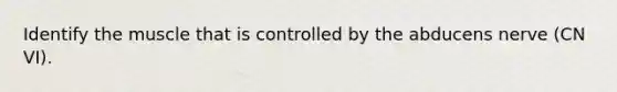 Identify the muscle that is controlled by the abducens nerve (CN VI).