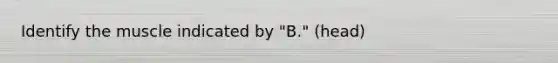 Identify the muscle indicated by "B." (head)