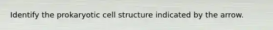 Identify the prokaryotic cell structure indicated by the arrow.
