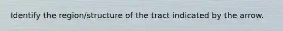 Identify the region/structure of the tract indicated by the arrow.