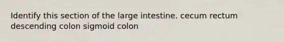 Identify this section of the <a href='https://www.questionai.com/knowledge/kGQjby07OK-large-intestine' class='anchor-knowledge'>large intestine</a>. cecum rectum descending colon sigmoid colon