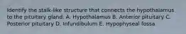 Identify the stalk-like structure that connects the hypothalamus to the pituitary gland. A. Hypothalamus B. Anterior pituitary C. Posterior pituitary D. Infundibulum E. Hypophyseal fossa