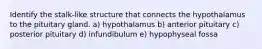 Identify the stalk-like structure that connects the hypothalamus to the pituitary gland. a) hypothalamus b) anterior pituitary c) posterior pituitary d) infundibulum e) hypophyseal fossa