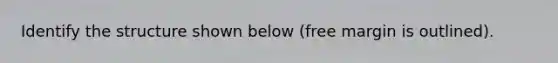 Identify the structure shown below (free margin is outlined).