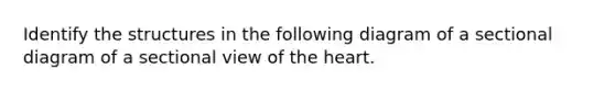 Identify the structures in the following diagram of a sectional diagram of a sectional view of the heart.