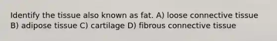 Identify the tissue also known as fat. A) loose connective tissue B) adipose tissue C) cartilage D) fibrous connective tissue