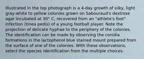 Illustrated in the top photograph is a 4-day growth of silky, light gray-white to yellow colonies grown on Sabouraud's dextrose agar incubated at 30° C, recovered from an "athlete's foot" infection (tinea pedis) of a young football player. Note the projection of delicate hyphae to the periphery of the colonies. The identification can be made by observing the conidia formations in the lactophenol blue stained mount prepared from the surface of one of the colonies. With these observations, select the species identification from the multiple choices.