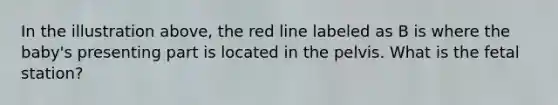 In the illustration above, the red line labeled as B is where the baby's presenting part is located in the pelvis. What is the fetal station?