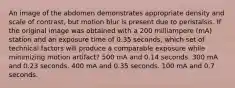 An image of the abdomen demonstrates appropriate density and scale of contrast, but motion blur is present due to peristalsis. If the original image was obtained with a 200 milliampere (mA) station and an exposure time of 0.35 seconds, which set of technical factors will produce a comparable exposure while minimizing motion artifact? 500 mA and 0.14 seconds. 300 mA and 0.23 seconds. 400 mA and 0.35 seconds. 100 mA and 0.7 seconds.