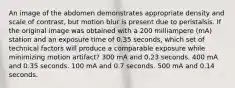 An image of the abdomen demonstrates appropriate density and scale of contrast, but motion blur is present due to peristalsis. If the original image was obtained with a 200 milliampere (mA) station and an exposure time of 0.35 seconds, which set of technical factors will produce a comparable exposure while minimizing motion artifact? 300 mA and 0.23 seconds. 400 mA and 0.35 seconds. 100 mA and 0.7 seconds. 500 mA and 0.14 seconds.