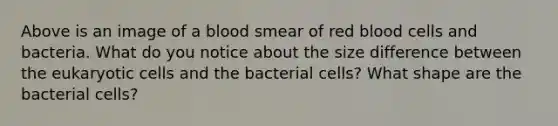 Above is an image of a blood smear of red blood cells and bacteria. What do you notice about the size difference between the <a href='https://www.questionai.com/knowledge/kb526cpm6R-eukaryotic-cells' class='anchor-knowledge'>eukaryotic cells</a> and the bacterial cells? What shape are the bacterial cells?