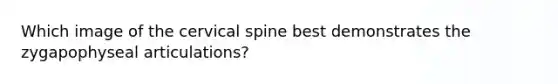 Which image of the cervical spine best demonstrates the zygapophyseal articulations?