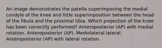 An image demonstrates the patella superimposing the medial condyle of the knee and little superimposition between the head of the fibula and the proximal tibia. Which projection of the knee has been correctlly performed? Anteroposterior (AP) with medial rotation. Anteroposterior (AP). Mediolateral lateral. Anteroposterior (AP) with lateral rotation.