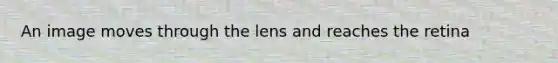 An image moves through the lens and reaches the retina