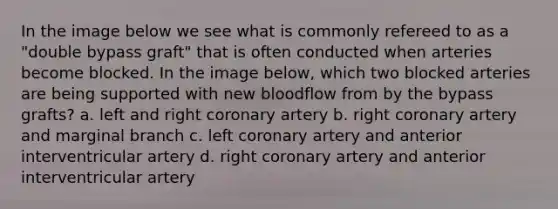 In the image below we see what is commonly refereed to as a "double bypass graft" that is often conducted when arteries become blocked. In the image below, which two blocked arteries are being supported with new bloodflow from by the bypass grafts? a. left and right coronary artery b. right coronary artery and marginal branch c. left coronary artery and anterior interventricular artery d. right coronary artery and anterior interventricular artery