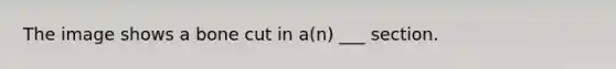 The image shows a bone cut in a(n) ___ section.