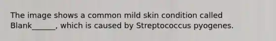 The image shows a common mild skin condition called Blank______, which is caused by Streptococcus pyogenes.