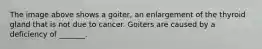 The image above shows a goiter, an enlargement of the thyroid gland that is not due to cancer. Goiters are caused by a deficiency of _______.