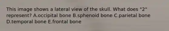 This image shows a lateral view of the skull. What does "2" represent? A.occipital bone B.sphenoid bone C.parietal bone D.temporal bone E.frontal bone