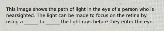 This image shows the path of light in the eye of a person who is nearsighted. The light can be made to focus on the retina by using a ______ to ______ the light rays before they enter the eye.