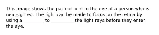 This image shows the path of light in the eye of a person who is nearsighted. The light can be made to focus on the retina by using a _________ to __________ the light rays before they enter the eye.