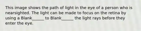 This image shows the path of light in the eye of a person who is nearsighted. The light can be made to focus on the retina by using a Blank______ to Blank______ the light rays before they enter the eye.