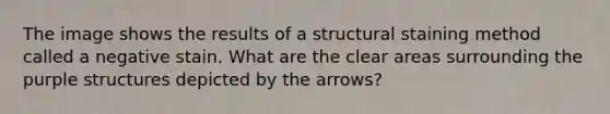 The image shows the results of a structural staining method called a negative stain. What are the clear areas surrounding the purple structures depicted by the arrows?