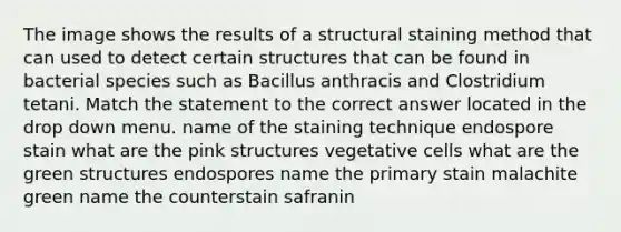 The image shows the results of a structural staining method that can used to detect certain structures that can be found in bacterial species such as Bacillus anthracis and Clostridium tetani. Match the statement to the correct answer located in the drop down menu. name of the staining technique endospore stain what are the pink structures vegetative cells what are the green structures endospores name the primary stain malachite green name the counterstain safranin