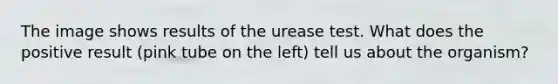 The image shows results of the urease test. What does the positive result (pink tube on the left) tell us about the organism?
