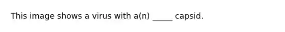 This image shows a virus with a(n) _____ capsid.