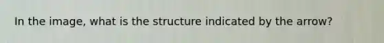 In the image, what is the structure indicated by the arrow?