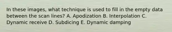 In these images, what technique is used to fill in the empty data between the scan lines? A. Apodization B. Interpolation C. Dynamic receive D. Subdicing E. Dynamic damping