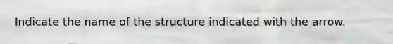 Indicate the name of the structure indicated with the arrow.