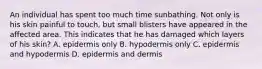 An individual has spent too much time sunbathing. Not only is his skin painful to touch, but small blisters have appeared in the affected area. This indicates that he has damaged which layers of his skin? A. epidermis only B. hypodermis only C. epidermis and hypodermis D. epidermis and dermis