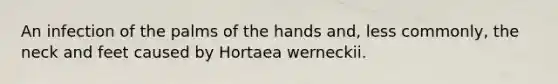 An infection of the palms of the hands and, less commonly, the neck and feet caused by Hortaea werneckii.